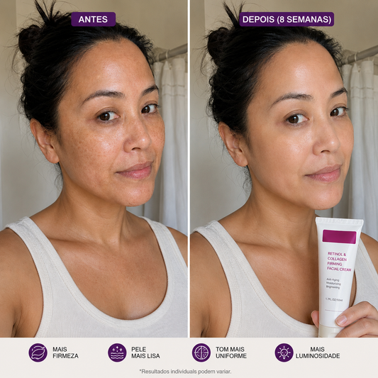 Dark Spot & Uneven Tone Cream Arbutin + Tranexamic Acid